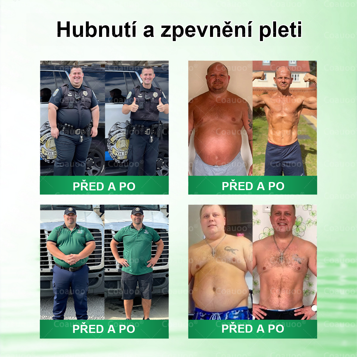 Oficiální prodejna  |  🧑‍⚕️𝐂𝐨𝐚𝐮𝐨𝐨® 𝐌𝐨𝐫𝐢𝐧𝐠𝐚 × 𝐁𝐞𝐫𝐛𝐞𝐫𝐲𝐧𝐚 × 𝐀𝐌𝐏𝐊 𝟏𝟎 v 1 – Zeštíhlující nano mikrojihlový náplast 🇨🇿 Jen 1× denně ✅ Viditelné změny za 7 dní – na obezitu, kardiovaskulární zdraví, diabetes a kloubní problémy